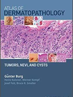 Atlas of Dermatopathology: Tumors; Nevi; and Cysts