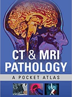 CT and MRI Pathology: A Pocket Atlas (3rd Edition)