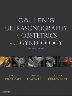 Callen’s Ultrasonography in Obstetrics and Gynecology (6th edition)
