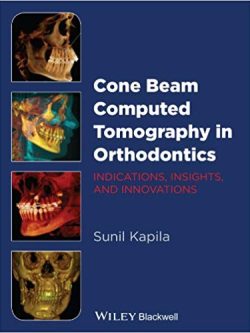 Cone Beam Computed Tomography in Orthodontics: Indications; Insights; and Innovations