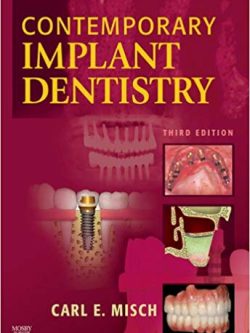 Contemporary Implant Dentistry (3rd Edition)