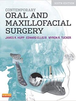 Contemporary Oral and Maxillofacial Surgery (6th Edition)