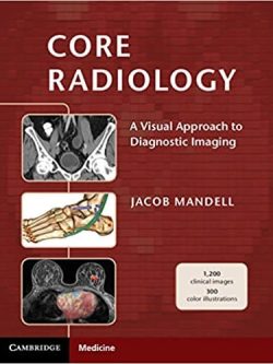 Core Radiology: A Visual Approach to Diagnostic Imaging