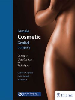 Female Cosmetic Genital Surgery: Concepts; Classification; and Techniques