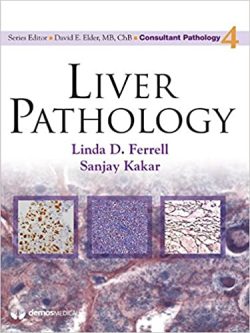 Liver Pathology (Consultant Pathology Book 4)