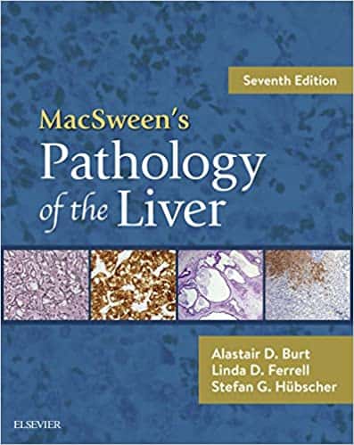MacSween’s Pathology of the Liver (7th Edition)