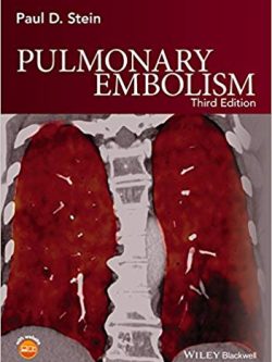 Pulmonary Embolism (3rd Edition)