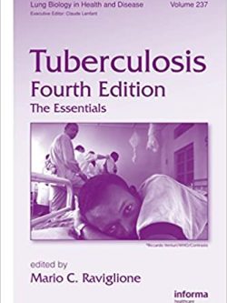 Tuberculosis: The Essentials (4th Edition)