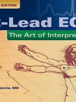 12-Lead ECG; The Art Of Interpretation (2nd Edition)