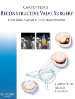 Carpentier’s Reconstructive Valve Surgery (1st Edition)