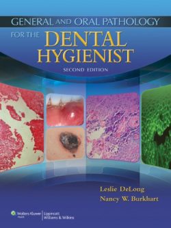 General and Oral Pathology for the Dental Hygienist (2nd Edition)